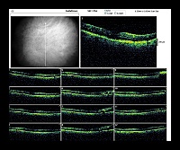 Radial Lines OS.jpg